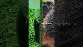 #whitehair #blackhair #haircare #ad #haircareremedy